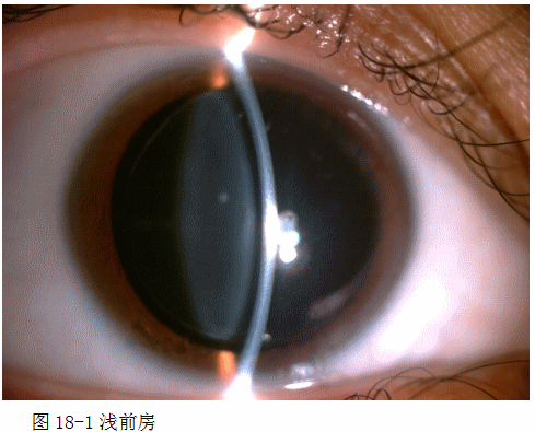 ZY016_90_2.gif